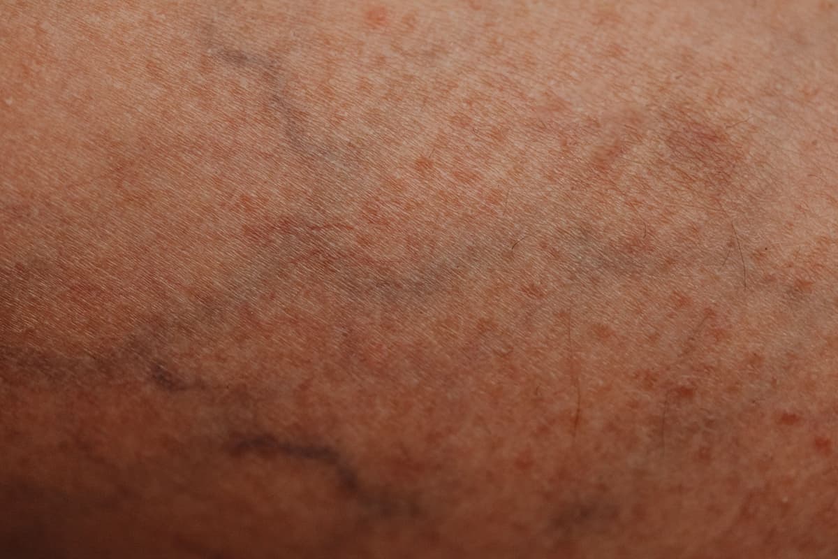 Dermatologie